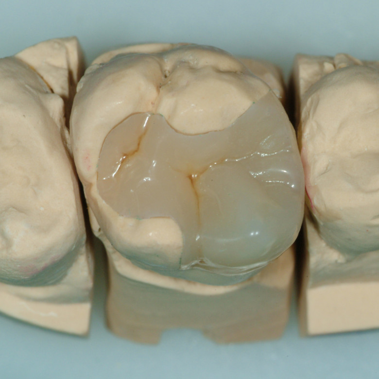 Conservativa dentaria bolzano